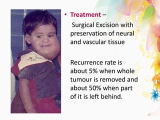 • Treatment –
Surgical Excision with
preservation of neural
and vascular tissue
Recurrence rate is
about 5% when whole
tumour is removed and
about 50% when part
of it is left behind.
13
 