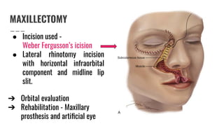 Malignant tumors of Nose and PNS | PDF
