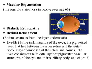  Macular Degeneration
(Irreversible vision loss in people over age 60)
 Diabetic Retinopathy
 Retinal Detachment
(Retina separates from the layer underneath)
 Uveitis ( Is the inflammation of the uvea, the pigmented
layer that lies between the inner retina and the outer
fibrous layer composed of the sclera and cornea. The
uvea consists of the middle layer of pigmented vascular
structures of the eye and in iris, ciliary body, and choroid)
 