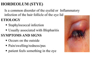 HORDEOLUM (STYE)
Is a common disorder of the eyelid or Inflammatory
infection of the hair follicle of the eye lid
ETIOLOGY
 Staphylococcal infection
 Usually associated with Blepharitis
SYMPTOMS AND SIGNS
 Occurs on the outside
 Pain/swelling/redness/pus
 patient feels something in the eye
 