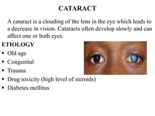 CATARACT
A cataract is a clouding of the lens in the eye which leads to
a decrease in vision. Cataracts often develop slowly and can
affect one or both eyes.
ETIOLOGY
 Old age
 Congenital
 Trauma
 Drug toxicity (high level of steroids)
 Diabetes mellitus
 
