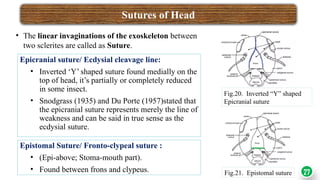 Stoma Inversion ENT-501 INSECT HEAD powerpoint presentation.pptx