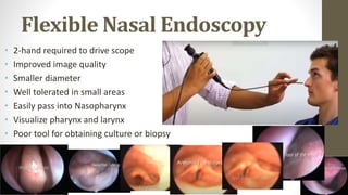 Chronic Rhinosinusitis with Nasal Polyposis grade III right | PPTX