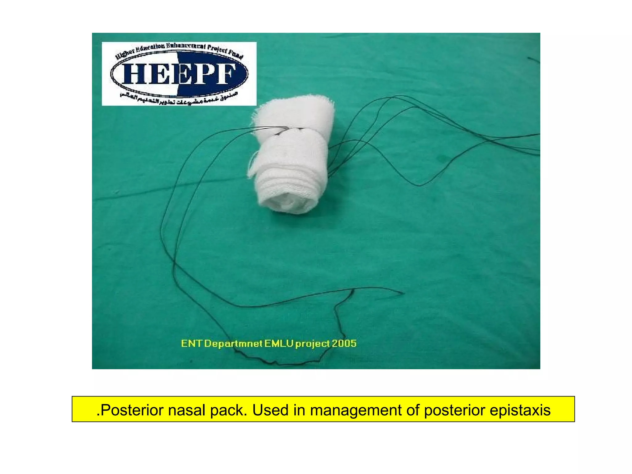 Ent instruments | PPT