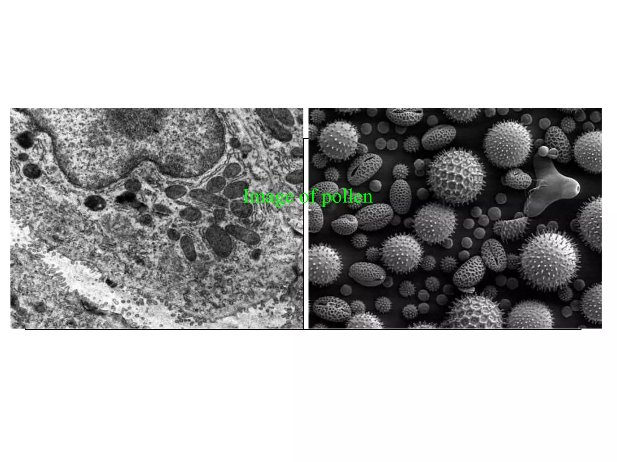 A Transmission Electron
Microscope (TEM) produces a 2D
image of a thin sample, and has a
maximum resolution of ×500000.
A Scanning Electron Microscope
(SEM) produces a 3D image of a
sample by 'bouncing' electons off and
dectecting them at multiple detectors.
It has a maximum magnification of
about ×100000.
Image of pollen
 