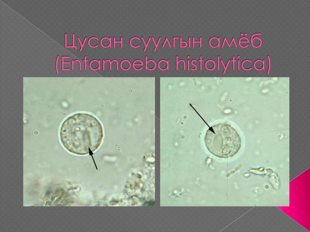 цусан суулгын амёб (Entameoba histolytica) | PPT