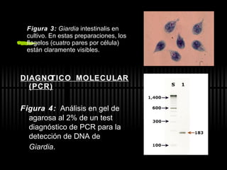 Figura 3:  Giardia  intestinalis en cultivo. En estas preparaciones, los flagelos (cuatro pares por célula) están claramente visibles. DIAGNÓTICO MOLECULAR (PCR) Figura 4:   Análisis en gel de agarosa al 2% de un test diagnóstico de PCR para la  detección de DNA de  Giardia .   