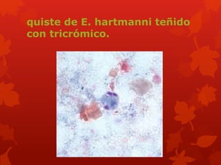 quiste de E. hartmanni teñido 
con tricrómico. 
 