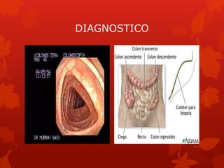 DIAGNOSTICO 
 