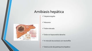Amibiasis hepática
 Hepatomegalia
 Abscesos
 Fiebre elevada
 Dolor en hipocondrio derecho
 A menudo leucocitosis con neutrofilia
 Destrucción de parénquima hepático
 