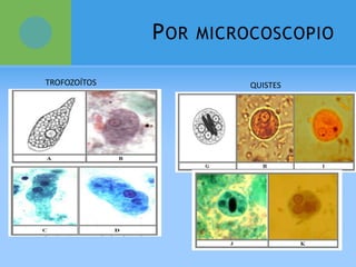 POR MICROCOSCOPIO
TROFOZOÍTOS QUISTES
 