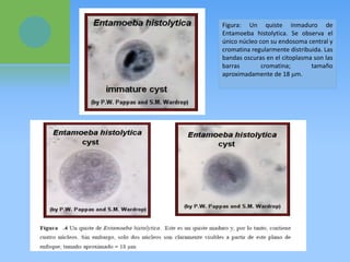 Figura: Un quiste inmaduro de
Entamoeba histolytica. Se observa el
único núcleo con su endosoma central y
cromatina regularmente distribuida. Las
bandas oscuras en el citoplasma son las
barras cromatina; tamaño
aproximadamente de 18 m.
 