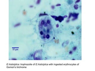 E.histolytica: trophozoite of E.histolytica with ingested erythrocytes of
Gomori‘s trichrome
 