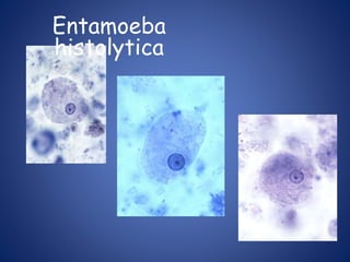 Entamoeba
histolytica
 