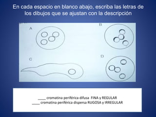 En cada espacio en blanco abajo, escriba las letras de
los dibujos que se ajustan con la descripción
____ cromatina periférica difusa FINA y REGULAR
____ cromatina periférica dispersa RUGOSA y IRREGULAR
 