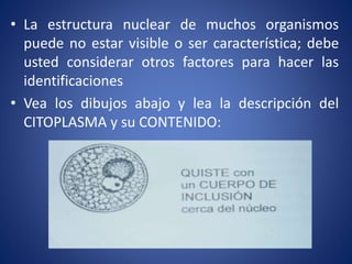 • La estructura nuclear de muchos organismos
puede no estar visible o ser característica; debe
usted considerar otros factores para hacer las
identificaciones
• Vea los dibujos abajo y lea la descripción del
CITOPLASMA y su CONTENIDO:
 