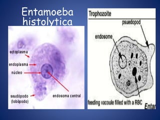 Entamoeba
histolytica
 