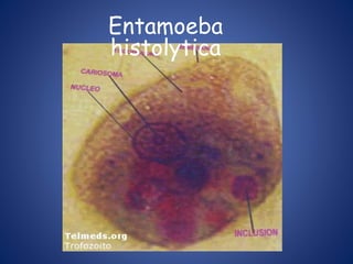 Entamoeba
histolytica
 
