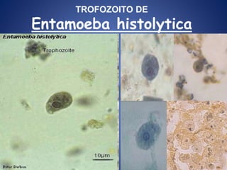 TROFOZOITO DE
Entamoeba histolytica
 