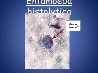 Entamoeba
histolytica
Que se
observa?
 