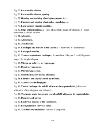 Fig. 75. Paratonsillar abscess.
Fig. 76. Paratonsillar abscess opening.
Fig. 77. Opening and draining of neck phlegmon (a, b, c).
Fig. 78. Puncture and opening of retropharyngeal abscess.
Fig. 79. Local signs of chronic tonsillitis.
Fig. 80. Steps of tonsillectomy: a – sites of anesthetic drugs introduction; b – tonsil
separation; c – tonsil incision.
Fig. 81. Adenoids.
Fig. 82. Adenotomy.
Fig. 83. Tonsillotomy.
Fig. 84. Cartilages and muscles of the larynx: a – front view, b – lateral view.
Fig. 85. Laryngeal muscles.
Fig. 86. Transverse section of the larynx: 1 – vestibule of larynx; 2 – middle part of
larynx; 3 – subglottal space.
Fig. 87. Mirror, or indirect, laryngoscopy.
Fig. 88. Direct laryngoscopy.
Fig. 89. Microlaryngoscopy.
Fig. 90. Noninflammatory edema of larynx.
Fig. 91. Edema of the larynx caused by its burn.
Fig. 92. Acute catarrhal laryngitis.
Fig. 93. View of the larynx in a child with acute laryngotracheitis (edema and
infiltration of the subglottal space tissues).
Fig. 94. Treatment under the oxygen tent of a child with acute laryngotracheitis.
Fig. 95. Diphtheria of larynx.
Fig. 96. Epidermic nodules of the vocal cords.
Fig. 97. Pachydermia of the vocal cords.
Fig. 98. Tracheostomy technique. Position of the patient.
224
 