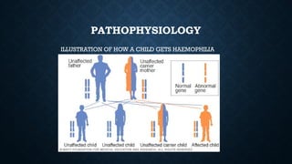 PATHOPHYSIOLOGY
ILLUSTRATION OF HOW A CHILD GETS HAEMOPHILIA
 
