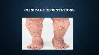 CLINICAL PRESENTATIONS
 