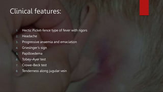 Lateral sinus thrombloplebitis and otitic hydrocephalus | PPTX