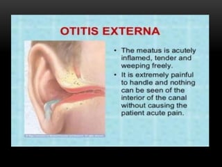 Ent disorder | PPTX