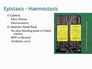 Epistaxis - Haemostasis
1) Cautery
Silver Nitrate
Electrocautery

2) Anterior Nasal Pack
No clear bleeding point or Failed
cautery
BIPP or Merocel
Antibiotic cover

 