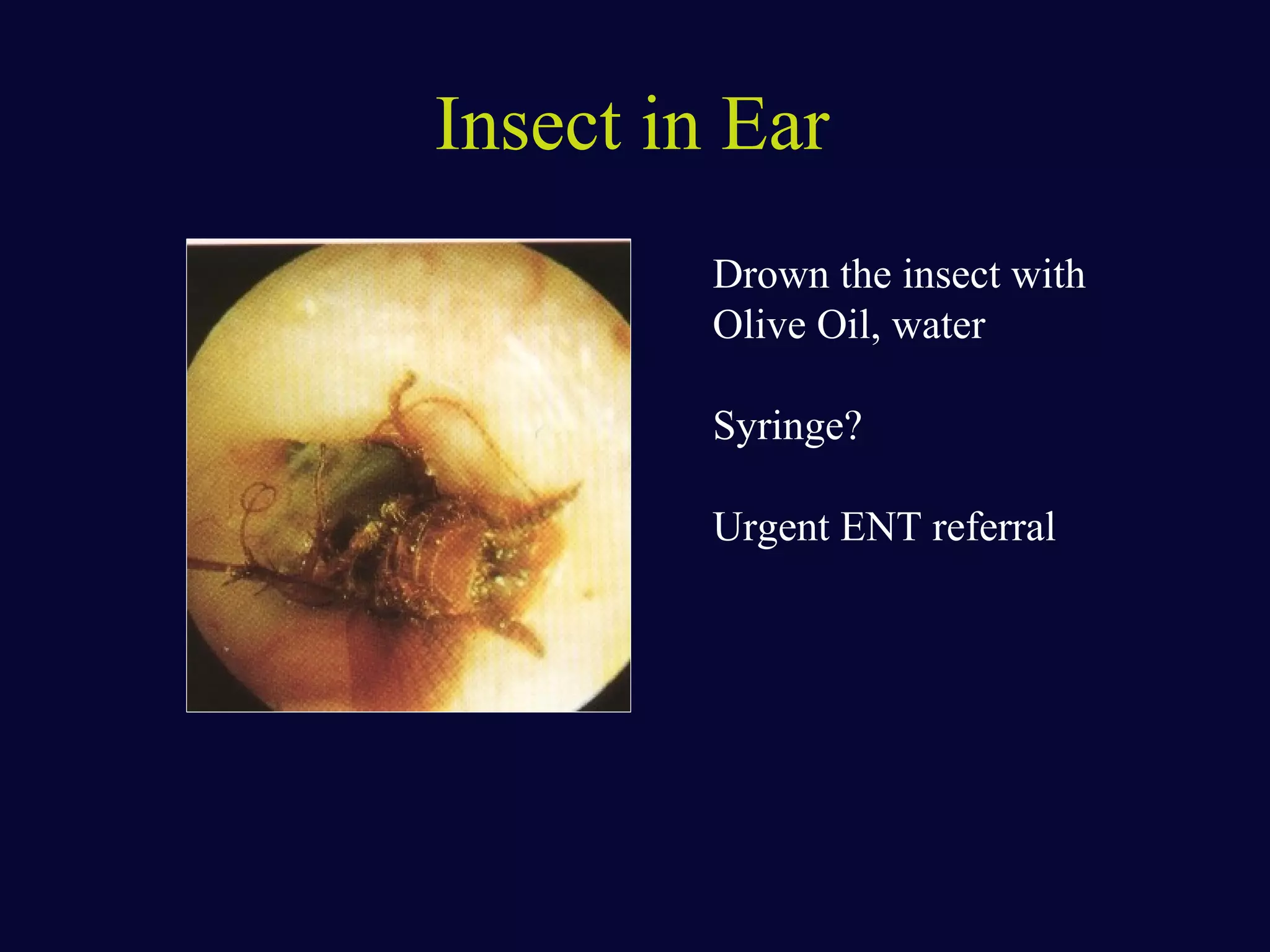 Common ENT casualties / emergencies and management strategies | PPT