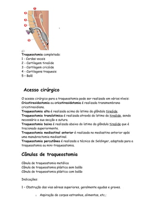 .




Traqueostomia completada:
1 - Cordas vocais
2 - Cartilagem tireóide
3 - Cartilagem cricóide
4 - Cartilagens traqueais
5 – Balã



 Acesso cirúrgico
O acesso cirúrgico para a traqueostomia pode ser realizado em vários níveis:
Cricotireoidostomia ou cricotireoidotomia é realizada transmembrana
cricotireoidiana.
Traqueostomia alta é realizada acima do ístimo da glândula tireóide.
Traqueostomia transístimica é realizada através do ístimo da tireóide, sendo
necessário a sua secção e sutura.
Traqueostomia baixa é realizada abaixo do ístimo da glândula tireóide que é
tracionado superiormente.
Traqueostomia mediastinal anterior é realizada no mediastino anterior após
uma manubrectomia mediastinal.
Traqueostomia percutânea é realizada a técnica de Seldinger, adaptada para a
traqueostomia ou mini-traqueostomia.


Cânulas de traqueostomia
Cânula de traqueostomia metálica
Cânula de traqueostomia plástica sem balão
Cânula de traqueostomia plástica com balão

Indicações:

1 – Obstrução das vias aéreas superiores, geralmente agudas e graves.

         o    Aspiração de corpos estranhos, alimentos, etc.;
 