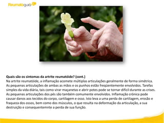 Quais são os sintomas da artrite reumatóide? (cont.)
Na artrite reumatóide, a inflamação acomete múltiplas articulações geralmente de forma simétrica.
As pequenas articulações de ambas as mãos e os punhos estão freqüentemente envolvidos. Tarefas
simples da vida diária, tais como virar maçanetas e abrir potes pode se tornar difícil durante as crises.
As pequenas articulações dos pés são também comumente envolvidos. Inflamação crónica pode
causar danos aos tecidos do corpo, cartilagem e osso. Isto leva a uma perda de cartilagem, erosão e
fraqueza dos ossos, bem como dos músculos, o que resulta na deformação da articulação, a sua
destruição e consequentemnte a perda de sua função.
 