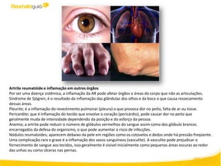 Artrite reumatóide e inflamação em outros órgãos
Por ser uma doença sistêmica, a inflamação da AR pode afetar órgãos e áreas do corpo que não as articulações.
Síndrome de Sjögren; é o resultado da inflamação das glândulas dos olhos e da boca o que causa ressecamento
dessas áreas.
Pleurite; é a inflamação do revestimento pulmonar (pleura) o que provoca dor no peito, falta de ar ou tosse.
Pericardite; que é Inflamação do tecido que envolve o coração (pericárdio), pode causar dor no peito que
geralmente muda de intensidade dependendo da posição e do esforço da pessoa.
Anemia; a artrite pode reduzir o número de glóbulos vermelhos do sangue assim como dos glóbulo brancos
encarregados da defesa do organismo, o que pode aumentar o risco de infecções.
Nódulos reumatoides; aparecem debaixo da pele em regiões como os cotovelos e dedos onde há pressão freqüente.
Uma complicação rara e grave é a inflamação dos vasos sanguíneos (vasculite). A vasculite pode prejudicar o
fornecimento de sangue aos tecidos, isso geralmente é visível inicialmente como pequenas áreas escuras ao redor
das unhas ou como úlceras nas pernas.
 