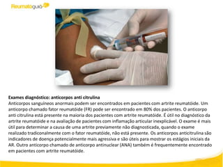 Exames diagnóstico: anticorpos anti citrulina
Anticorpos sanguíneos anormais podem ser encontrados em pacientes com artrite reumatóide. Um
anticorpo chamado fator reumatóide (FR) pode ser encontrado em 80% dos pacientes. O anticorpo
anti citrulina está presente na maioria dos pacientes com artrite reumatóide. É útil no diagnóstico da
artrite reumatóide e na avaliação de pacientes com inflamação articular inexplicável. O exame é mais
útil para determinar a causa de uma artrite previamente não diagnosticada, quando o exame
realizado tradiconalmente com o fator reumatóide, não está presente. Os anticorpos anticitrulina são
indicadores de doença potencialmente mais agressiva e são úteis para mostrar os estágios iniciais da
AR. Outro anticorpo chamado de anticorpo antinuclear (ANA) também é frequentemente encontrado
em pacientes com artrite reumatóide.
 