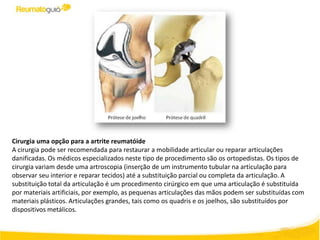 Cirurgia uma opção para a artrite reumatóide
A cirurgia pode ser recomendada para restaurar a mobilidade articular ou reparar articulações
danificadas. Os médicos especializados neste tipo de procedimento são os ortopedistas. Os tipos de
cirurgia variam desde uma artroscopia (inserção de um instrumento tubular na articulação para
observar seu interior e reparar tecidos) até a substituição parcial ou completa da articulação. A
substituição total da articulação é um procedimento cirúrgico em que uma articulação é substituída
por materiais artificiais, por exemplo, as pequenas articulações das mãos podem ser substituídas com
materiais plásticos. Articulações grandes, tais como os quadris e os joelhos, são substituídos por
dispositivos metálicos.
 