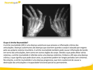 O que é Artrite Reumatóide?
A artrite reumatóide (AR) é uma doença autoimune que provoca a inflamação crônica das
articulações. Doenças autoimunes são doenças que ocorrem quando o corpo é atacado por engano
pelo seu próprio sistema imunitário. A artrite reumatóide também pode causar inflamação do tecido
em torno das articulações, bem como em outros órgãos do corpo. Devido a que pode afetar vários
sistemas, a artrite reumatóide é referida como uma doença sistémica. Embora a AR seja uma doença
crônica, o que significa que pode durar anos, os pacientes podem ter longos períodos sem sintomas.
No entanto, a artrite reumatóide é uma doença progressiva, que tem o potencial de causar a
destruição das articulações e incapacidade funcional parcial ou permanente.
 