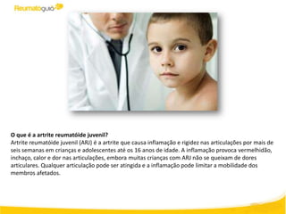 O que é a artrite reumatóide juvenil?
Artrite reumatóide juvenil (ARJ) é a artrite que causa inflamação e rigidez nas articulações por mais de
seis semanas em crianças e adolescentes até os 16 anos de idade. A inflamação provoca vermelhidão,
inchaço, calor e dor nas articulações, embora muitas crianças com ARJ não se queixam de dores
articulares. Qualquer articulação pode ser atingida e a inflamação pode limitar a mobilidade dos
membros afetados.
 