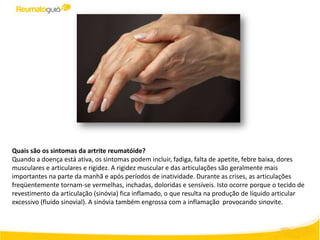Quais são os sintomas da artrite reumatóide?
Quando a doença está ativa, os sintomas podem incluir, fadiga, falta de apetite, febre baixa, dores
musculares e articulares e rigidez. A rigidez muscular e das articulações são geralmente mais
importantes na parte da manhã e após períodos de inatividade. Durante as crises, as articulações
freqüentemente tornam-se vermelhas, inchadas, doloridas e sensíveis. Isto ocorre porque o tecido de
revestimento da articulação (sinóvia) fica inflamado, o que resulta na produção de líquido articular
excessivo (fluido sinovial). A sinóvia também engrossa com a inflamação provocando sinovite.
 
