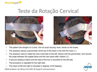 Teste da Rotação Cervical
 