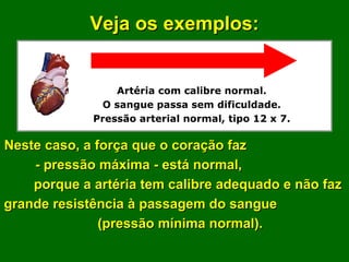 Artéria com calibre normal. O sangue passa sem dificuldade. Pressão arterial normal, tipo 12 x 7. Veja os exemplos: Neste caso, a força que o coração faz  - pressão máxima - está normal,  porque a artéria tem calibre adequado e não faz grande resistência à passagem do sangue  (pressão mínima normal).  