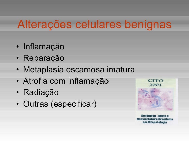 Alterações Celulares Benignas Reativas Ou Reparativas Associadas A Inflamação