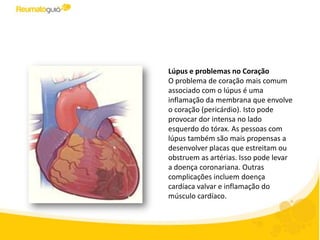 Lúpus e problemas no Coração
O problema de coração mais comum
associado com o lúpus é uma
inflamação da membrana que envolve
o coração (pericárdio). Isto pode
provocar dor intensa no lado
esquerdo do tórax. As pessoas com
lúpus também são mais propensas a
desenvolver placas que estreitam ou
obstruem as artérias. Isso pode levar
a doença coronariana. Outras
complicações incluem doença
cardíaca valvular e inflamação do
músculo cardíaco.
 