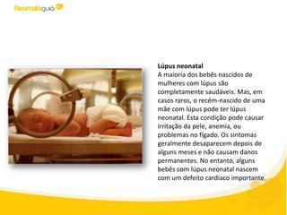 Lúpus neonatal
A maioria dos bebês nascidos de
mulheres com lúpus são
completamente saudáveis. Mas, em
casos raros, o recém-nascido de uma
mãe com lúpus pode ter lúpus
neonatal. Esta condição pode causar
irritação da pele, anemia, ou
problemas no fígado. Os sintomas
geralmente desaparecem depois de
alguns meses e não causam danos
permanentes. No entanto, alguns
bebês com lúpus neonatal nascem
com um defeito cardíaco importante.
 