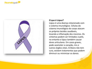 O que é Lúpus?
Lúpus é uma doença relacionada com
o sistema imunológico. Células do
sistema imunológico do corpo atacam
os próprios tecidos saudáveis​​,
levando a inflamação dos mesmos. Os
sintomas podem ser limitados à pele,
no entanto o lúpus também causar
dores articulares. Em casos graves,
pode acometer o coração, rins e
outros órgãos vitais. Embora não tem
cura, existem tratamentos que podem
diminuir ou minimizar os danos.
 