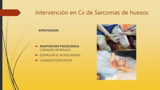 Intervención en Cx de Sarcomas de huesos
AMPUTACION:
 ADAPTACION PSICOLÓGICA
CUIDADOS GENERALES
 ESTIMULAR EL AUTOCUIDADO.
 CUIDADOS ESPECIFICOS
 