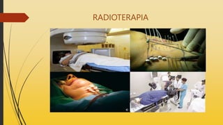 RADIOTERAPIA
 