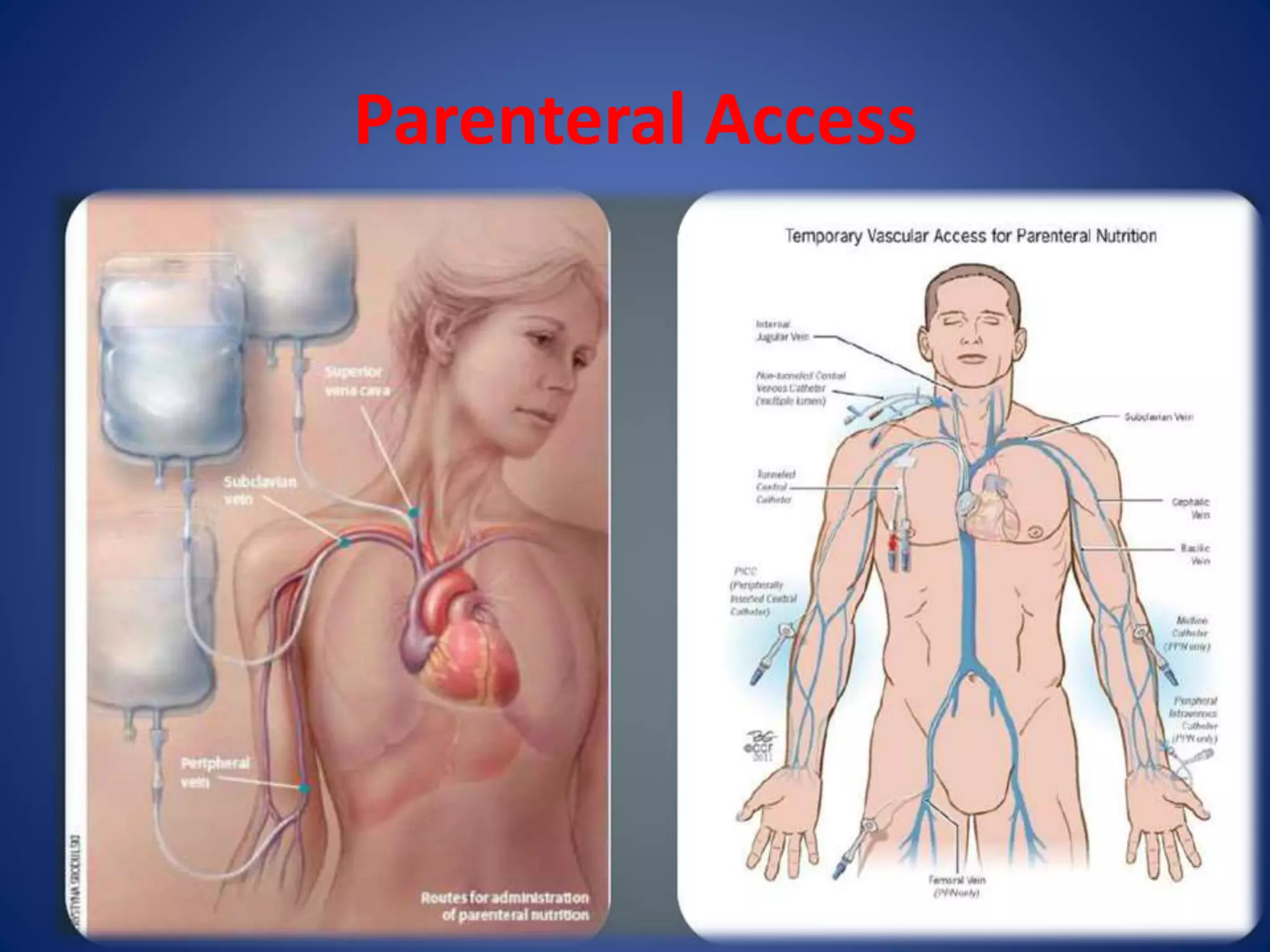 Enteral and Parenteral Nutrition | PPTX