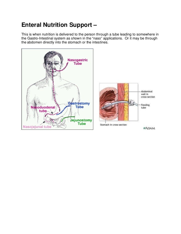 Enteral Nutrition Support Pictures