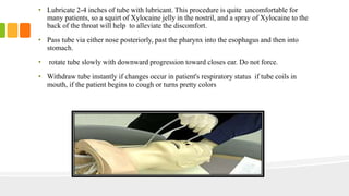Enteral Tube Feeding | PPTX